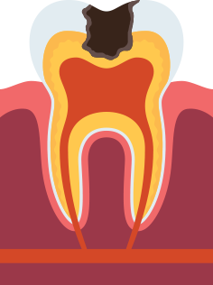 �ؽ��� ��ġ