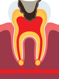 ���� ��ġ