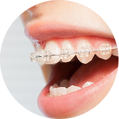 ����ġ��