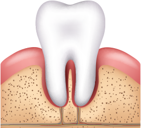 �ǰ��� ġ�ƿ� �ո�