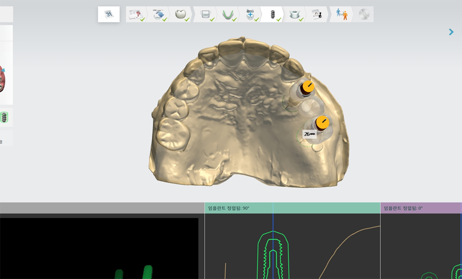 �ո��� �������� �ʱ� ������ ������ ������ ���� �����ϴ�!