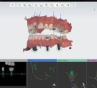 ���� ��ȹ