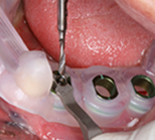 ���̵� ����