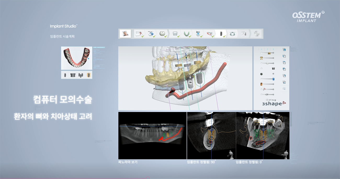 ���� ����ϱ�