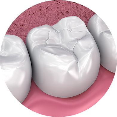 �Ƕ�Ʈ(ġ�� Ȩ �޿��)